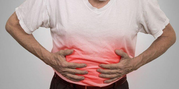 القولون العصبي.. أبرز أعراضه وكيفيه تمييزه عن الأمراض المُشابهة 1 القولون العصبي