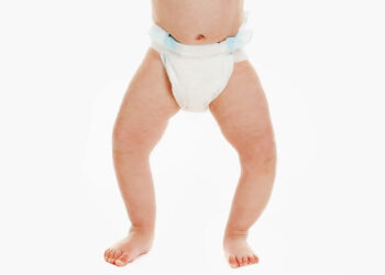 علاج لين العظام