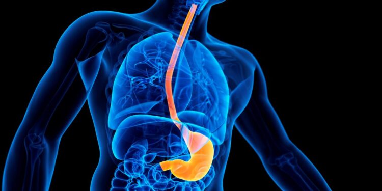 ارتجاع المريء.. أبرز الأعراض الظاهرية الدالة على الإصابة بالمرض 1 ارتجاع المريء