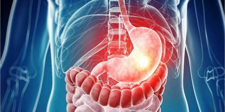 التهابات جدار المعدة