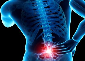 آلام العمود الفقري