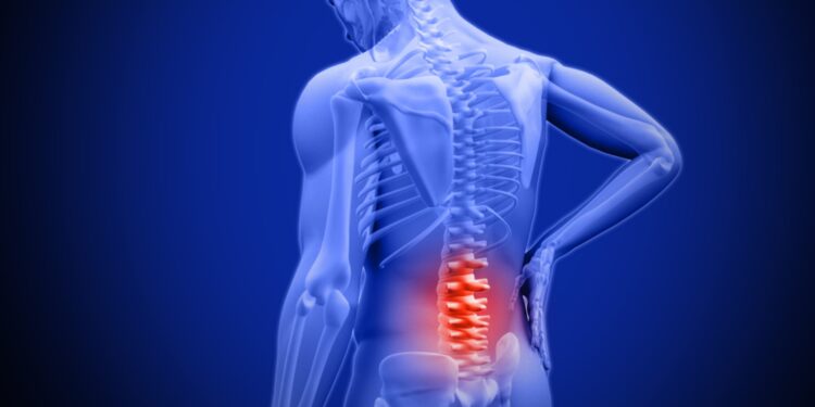 أمراض الظهر والعمود الفقري.. أشهر 4 تشخيصات شائعة وطرق علاجها 1 أمراض الظهر والعمود الفقري