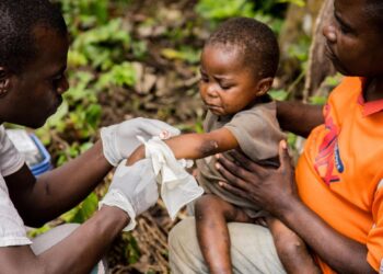 جدري القرود