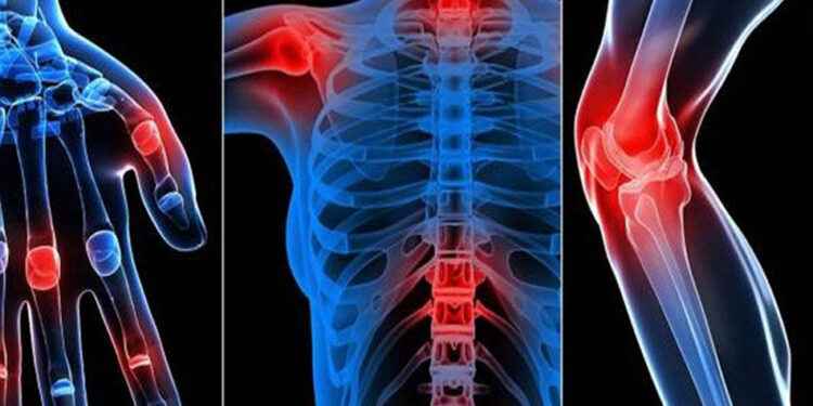 آلام المفاصل وعلاجها بالأعشاب الطبيعية 1 آلام المفاصل