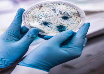 الحمل الميكروبي