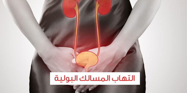 التهابات المسالك البولية