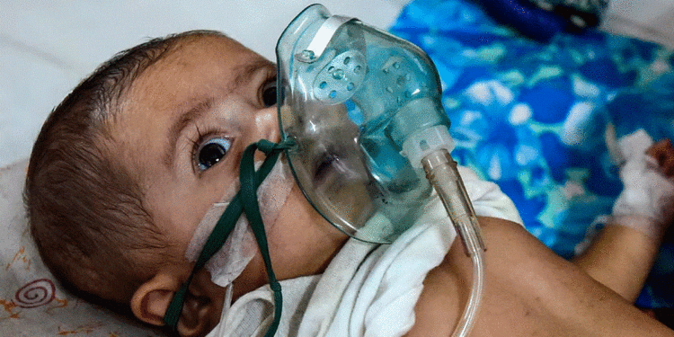 الفيروس المخلوي.. طُرق انتقال العدوى وفترة الحضانة والفئات الأكثر تضررًا 1 الفيروس المخلوي